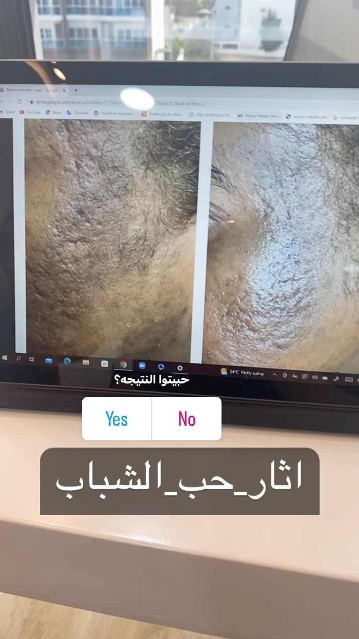 #